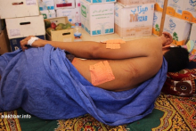 أحد عمال المحل التجاري أصيب خلال مقاومته أفراد العصابة (الأخبار)