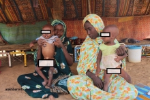 أطفال يعانون سوء التغذية في إحدى القرى بضواحي جكني شرقي موريتانيا (الأخبار)