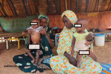 أطفال يعانون سوء التغذية في إحدى القرى بضواحي جكني شرقي موريتانيا (الأخبار - أرشيف)